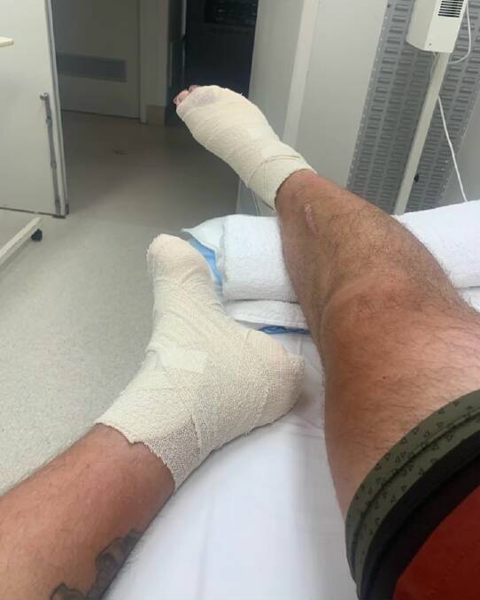 TOLL: Alan Thorpe's feet required hospital attention after 70 hours' worth of walking. 