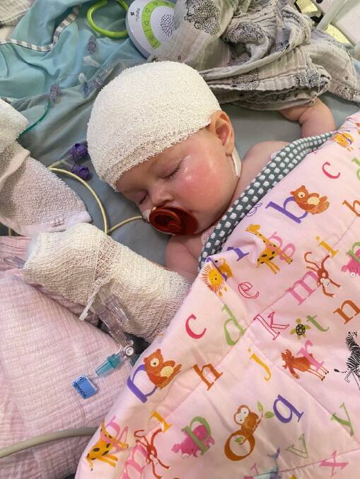 Zarliah sleeps after undergoing surgery to remove a brain tumour at the Royal Children's Hospital. Picture supplied