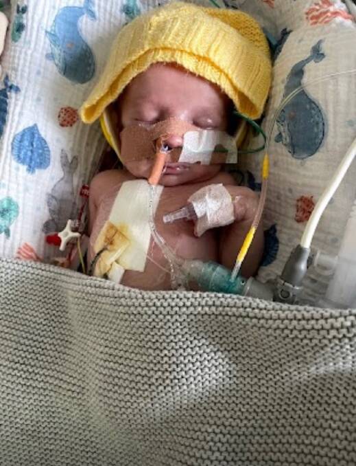 Jack after his first surgery when he was just two days old.